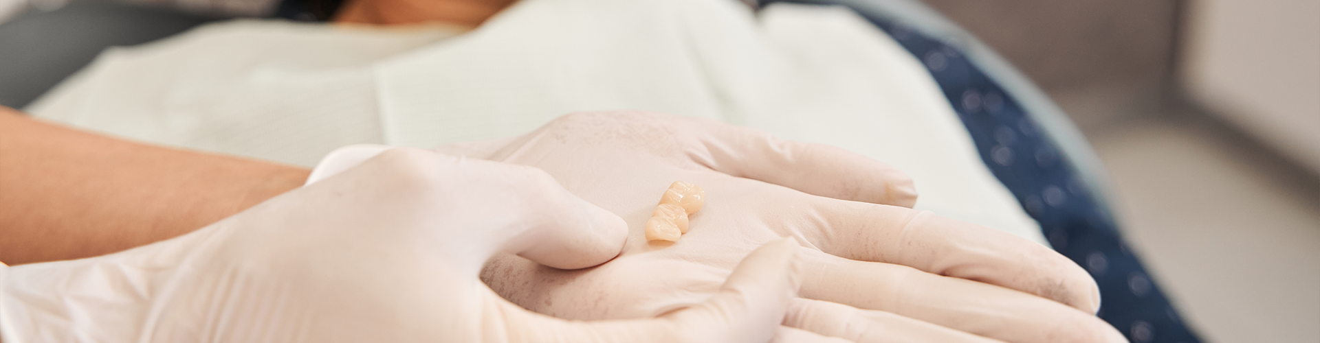 gloved hands holding extracted tooth in front of woman
